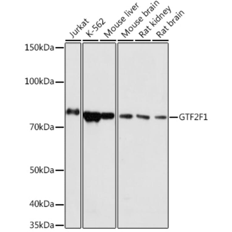 Western Blot - Anti-TFIIF Antibody (A308239) - Antibodies.com
