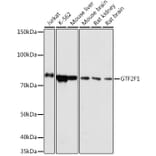 Western Blot - Anti-TFIIF Antibody (A308239) - Antibodies.com