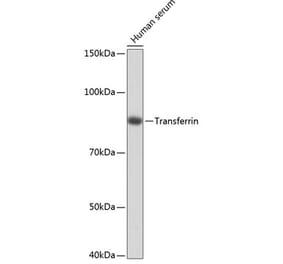 Western Blot - Anti-Transferrin Antibody [ARC0338] (A308242) - Antibodies.com