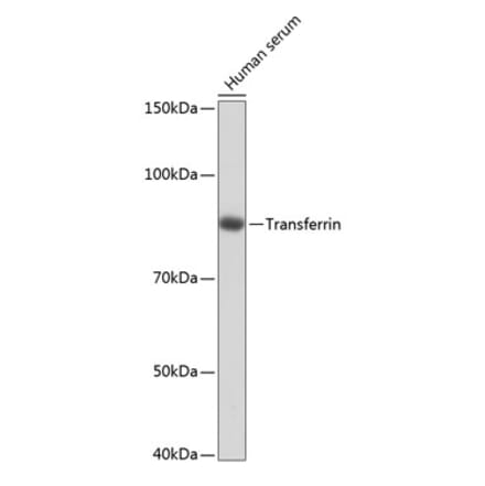 Western Blot - Anti-Transferrin Antibody [ARC0338] (A308242) - Antibodies.com