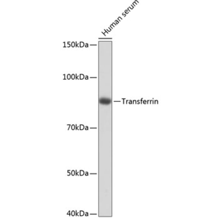 Western Blot - Anti-Transferrin Antibody [ARC0338] (A308242) - Antibodies.com