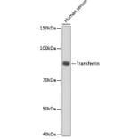 Western Blot - Anti-Transferrin Antibody [ARC0338] (A308242) - Antibodies.com