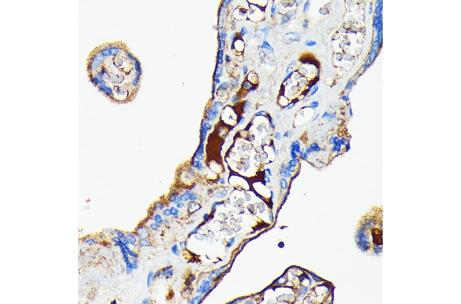 Immunohistochemistry - Anti-Transferrin Antibody [ARC0338] (A308242) - Antibodies.com