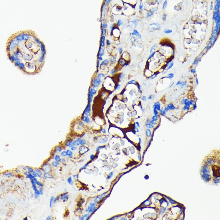 Immunohistochemistry - Anti-Transferrin Antibody [ARC0338] (A308242) - Antibodies.com