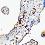 Immunohistochemistry - Anti-Transferrin Antibody [ARC0338] (A308242) - Antibodies.com