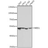 Western Blot - Anti-MEIS1 Antibody (A308243) - Antibodies.com