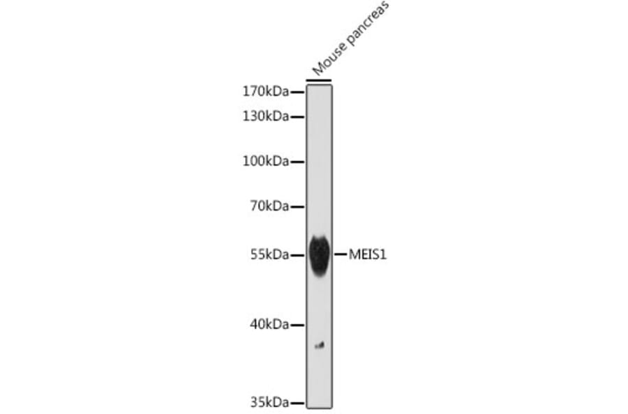 Western Blot - Anti-MEIS1 Antibody (A308243) - Antibodies.com