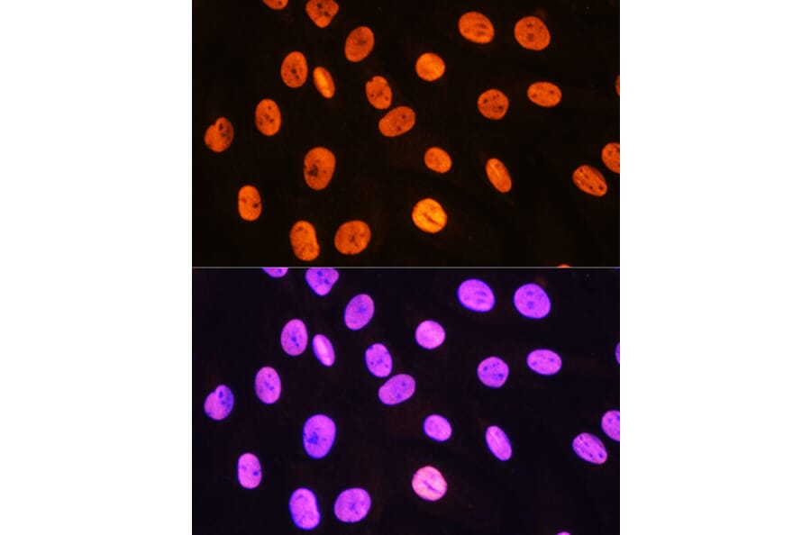 Immunofluorescence - Anti-MEIS1 Antibody (A308243) - Antibodies.com