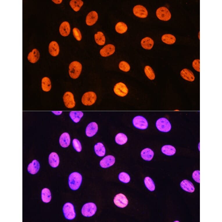 Immunofluorescence - Anti-MEIS1 Antibody (A308243) - Antibodies.com