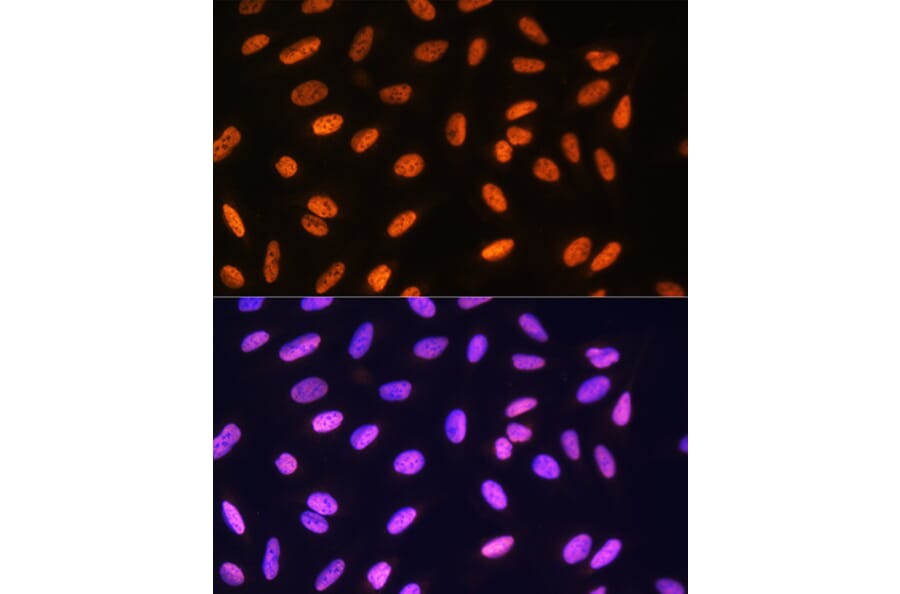 Immunofluorescence - Anti-MEIS1 Antibody (A308243) - Antibodies.com