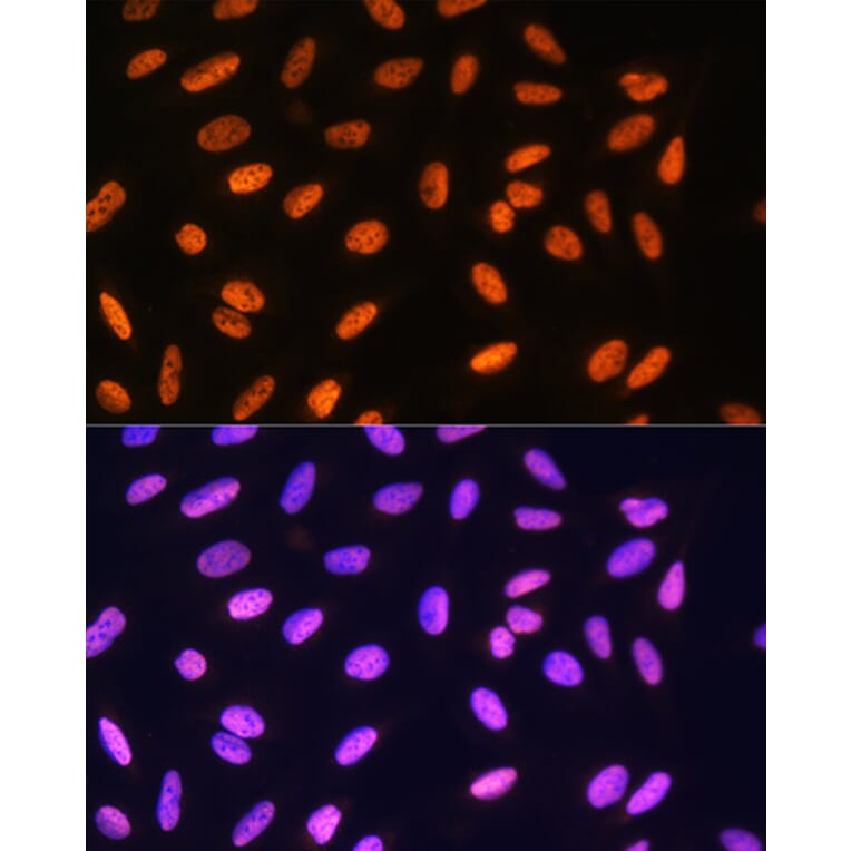 Immunofluorescence - Anti-MEIS1 Antibody (A308243) - Antibodies.com