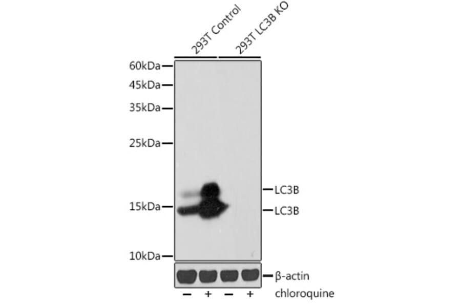 Western Blot - Anti-LC3B Antibody [ARC0144] (A308244) - Antibodies.com