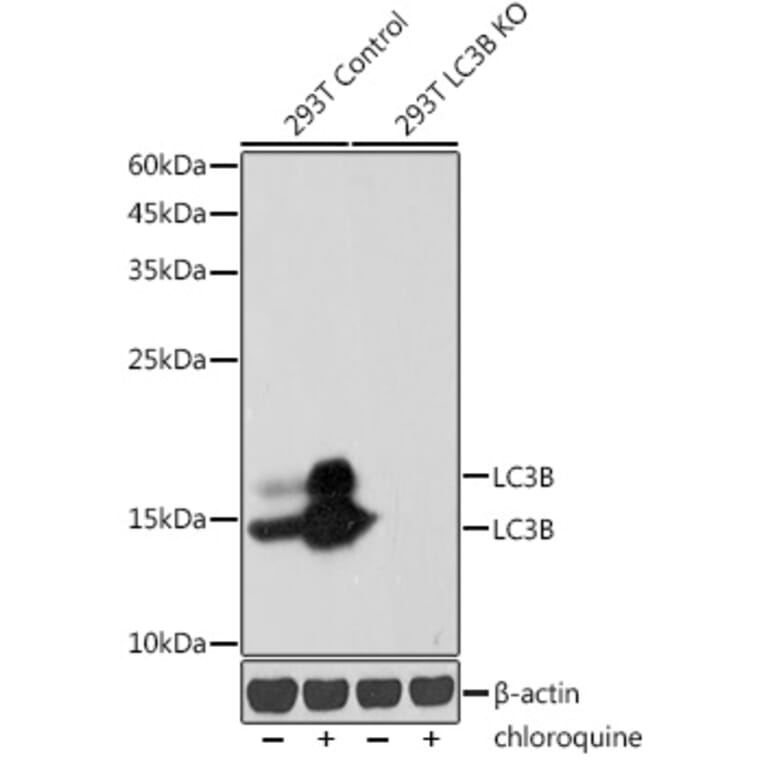 Western Blot - Anti-LC3B Antibody [ARC0144] (A308244) - Antibodies.com