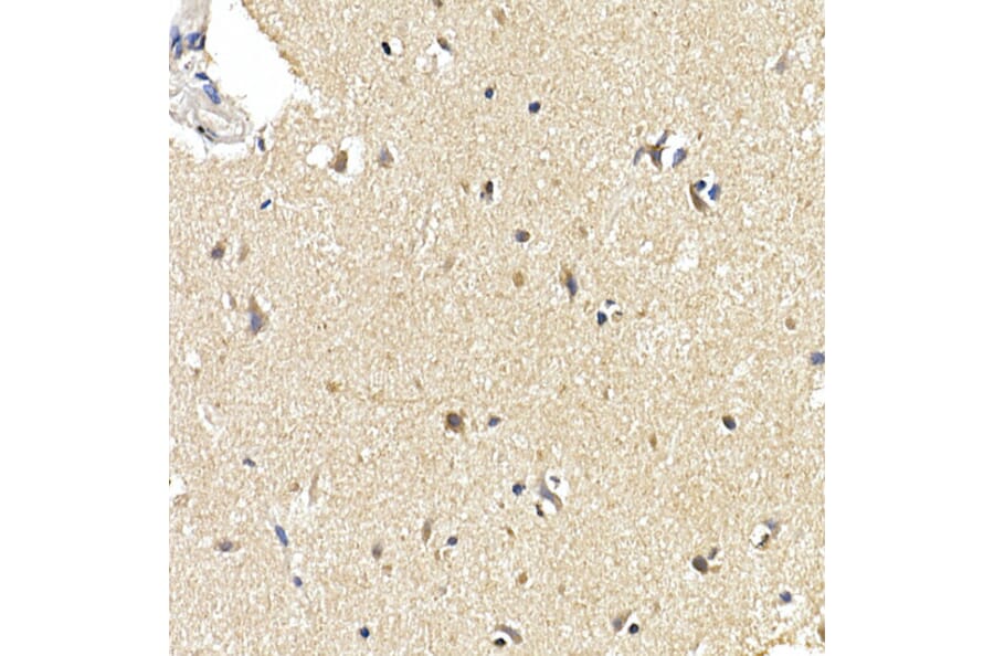 Immunohistochemistry - Anti-LC3B Antibody [ARC0144] (A308244) - Antibodies.com