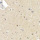 Immunohistochemistry - Anti-LC3B Antibody [ARC0144] (A308244) - Antibodies.com