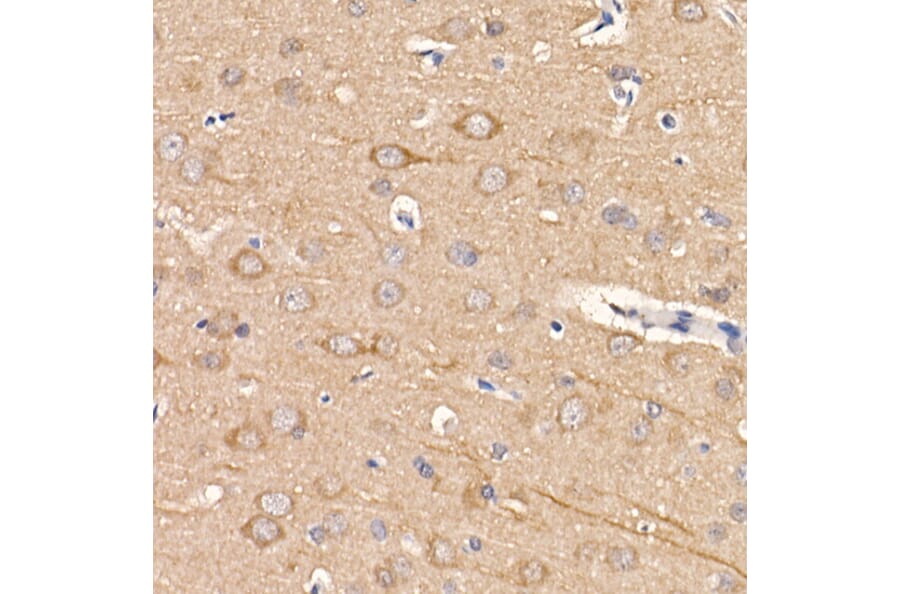 Immunohistochemistry - Anti-LC3B Antibody [ARC0144] (A308244) - Antibodies.com
