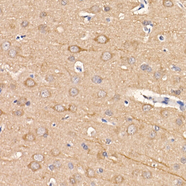 Immunohistochemistry - Anti-LC3B Antibody [ARC0144] (A308244) - Antibodies.com