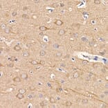 Immunohistochemistry - Anti-LC3B Antibody [ARC0144] (A308244) - Antibodies.com