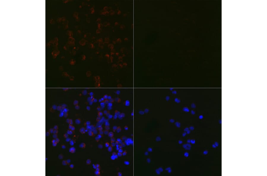 Immunofluorescence - Anti-LC3B Antibody [ARC0144] (A308244) - Antibodies.com