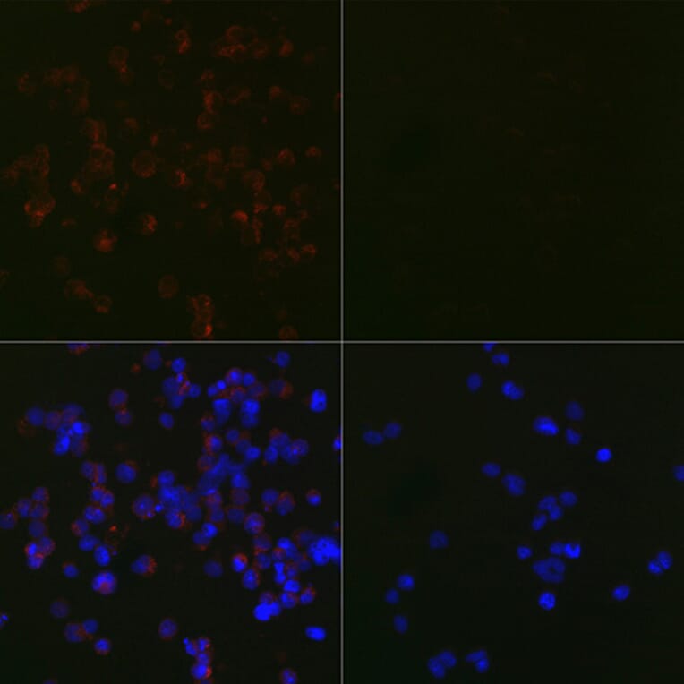 Immunofluorescence - Anti-LC3B Antibody [ARC0144] (A308244) - Antibodies.com