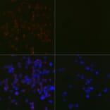 Immunofluorescence - Anti-LC3B Antibody [ARC0144] (A308244) - Antibodies.com