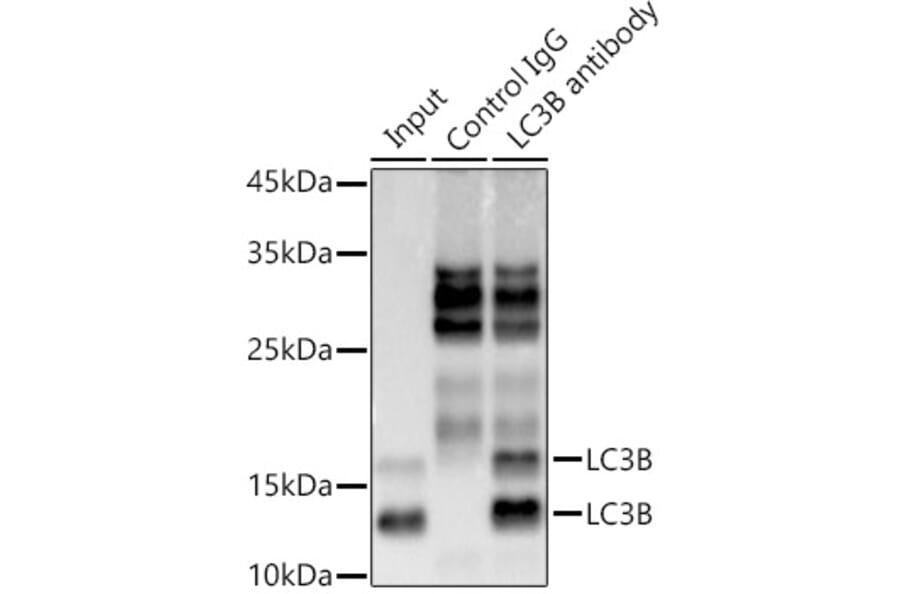 Western Blot - Anti-LC3B Antibody [ARC0144] (A308244) - Antibodies.com