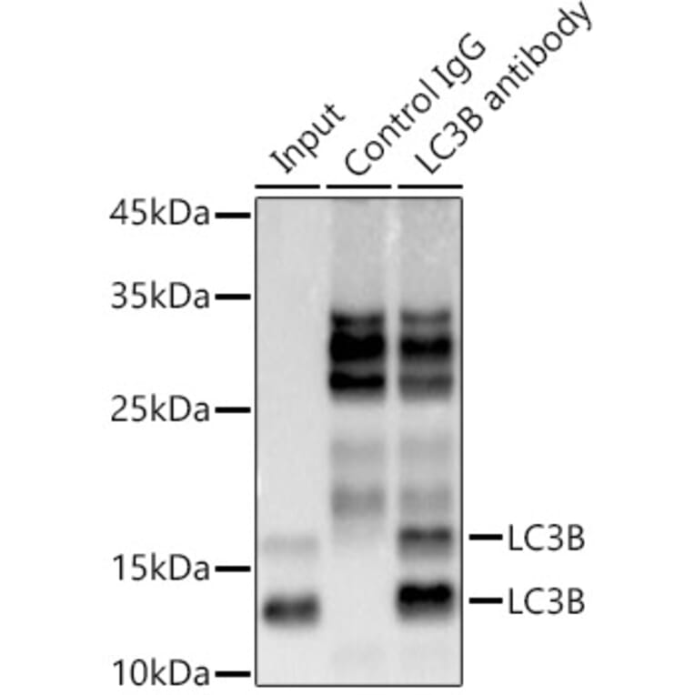 Western Blot - Anti-LC3B Antibody [ARC0144] (A308244) - Antibodies.com