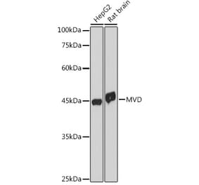 Western Blot - Anti-MVD Antibody [ARC2541] (A308245) - Antibodies.com