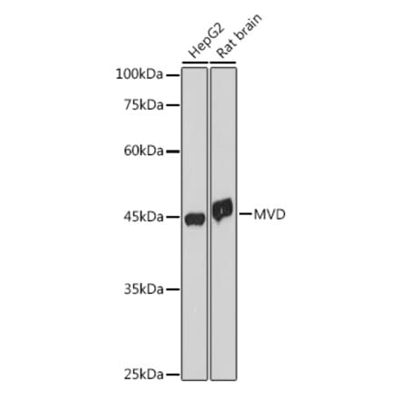 Western Blot - Anti-MVD Antibody [ARC2541] (A308245) - Antibodies.com