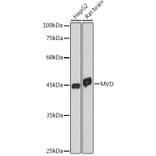 Western Blot - Anti-MVD Antibody [ARC2541] (A308245) - Antibodies.com