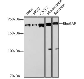 Western Blot - Anti-RhoGAP Antibody [ARC1916] (A308246) - Antibodies.com