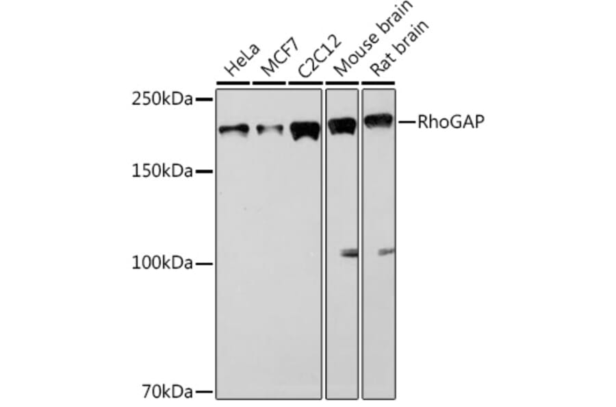Western Blot - Anti-RhoGAP Antibody [ARC1916] (A308246) - Antibodies.com