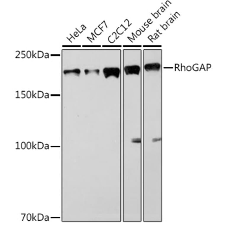 Western Blot - Anti-RhoGAP Antibody [ARC1916] (A308246) - Antibodies.com