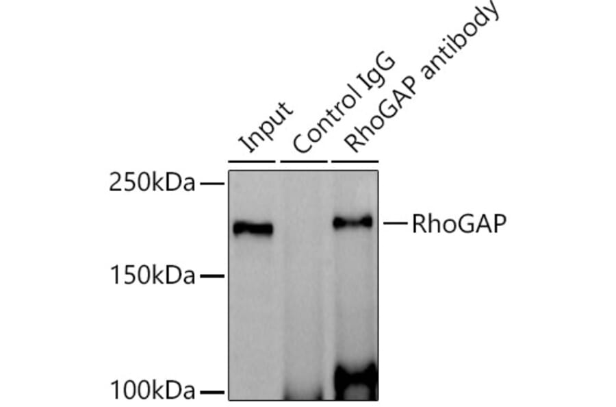 Western Blot - Anti-RhoGAP Antibody [ARC1916] (A308246) - Antibodies.com