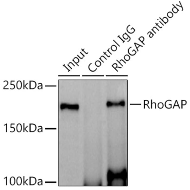 Western Blot - Anti-RhoGAP Antibody [ARC1916] (A308246) - Antibodies.com