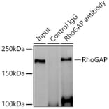 Western Blot - Anti-RhoGAP Antibody [ARC1916] (A308246) - Antibodies.com