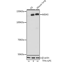 Western Blot - Anti-MDA5 Antibody [ARC0760] (A308247) - Antibodies.com