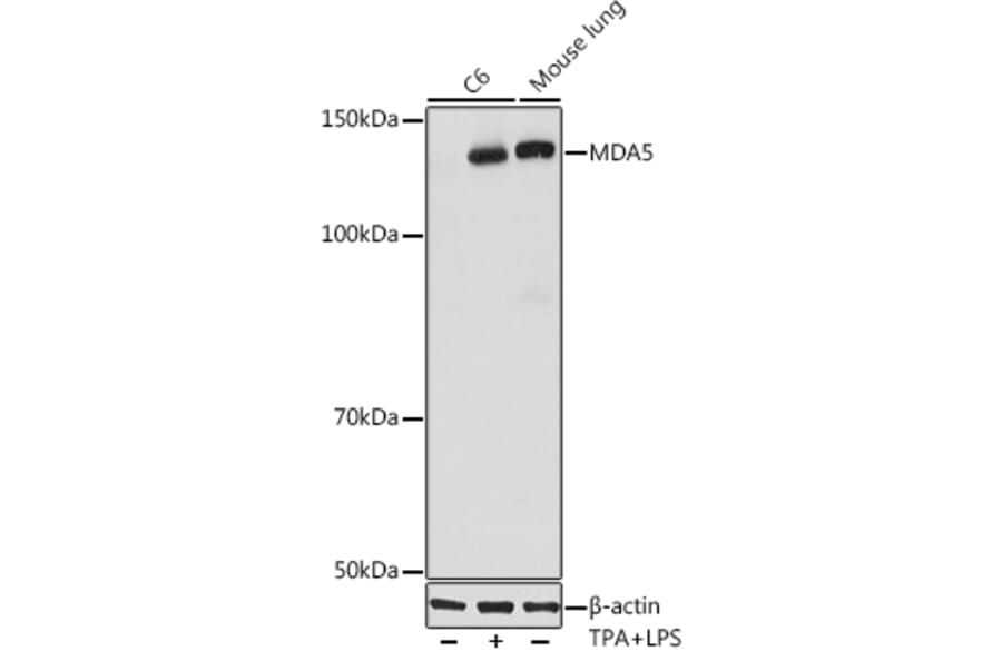 Western Blot - Anti-MDA5 Antibody [ARC0760] (A308247) - Antibodies.com