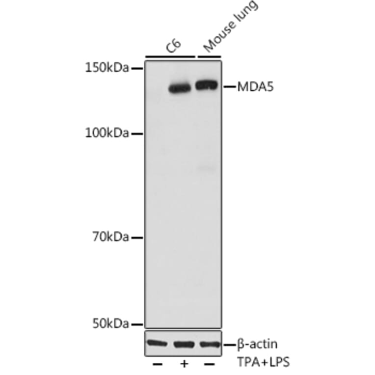 Western Blot - Anti-MDA5 Antibody [ARC0760] (A308247) - Antibodies.com