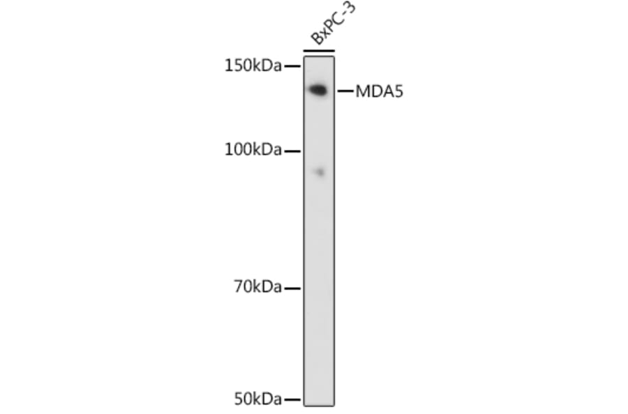 Western Blot - Anti-MDA5 Antibody [ARC0760] (A308247) - Antibodies.com