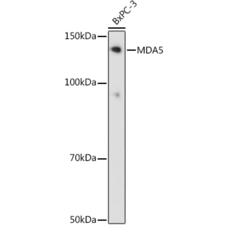 Western Blot - Anti-MDA5 Antibody [ARC0760] (A308247) - Antibodies.com