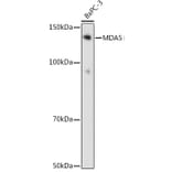 Western Blot - Anti-MDA5 Antibody [ARC0760] (A308247) - Antibodies.com