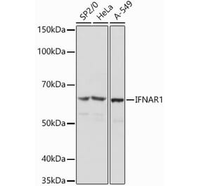 Western Blot - Anti-Interferon alpha/beta receptor 1 Antibody (A308248) - Antibodies.com