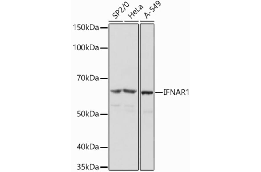 Western Blot - Anti-Interferon alpha/beta receptor 1 Antibody (A308248) - Antibodies.com