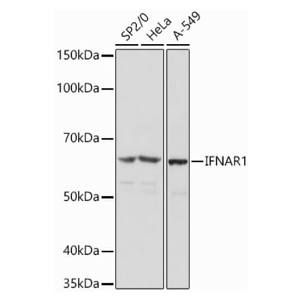 Western Blot - Anti-Interferon alpha/beta receptor 1 Antibody (A308248) - Antibodies.com