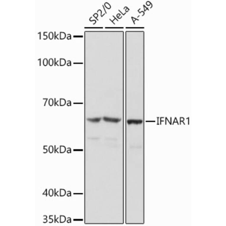 Western Blot - Anti-Interferon alpha/beta receptor 1 Antibody (A308248) - Antibodies.com