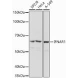 Western Blot - Anti-Interferon alpha/beta receptor 1 Antibody (A308248) - Antibodies.com