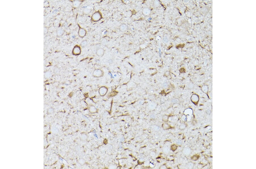 Immunohistochemistry - Anti-Interferon alpha/beta receptor 1 Antibody (A308248) - Antibodies.com
