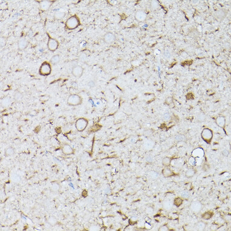 Immunohistochemistry - Anti-Interferon alpha/beta receptor 1 Antibody (A308248) - Antibodies.com