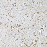 Immunohistochemistry - Anti-Interferon alpha/beta receptor 1 Antibody (A308248) - Antibodies.com